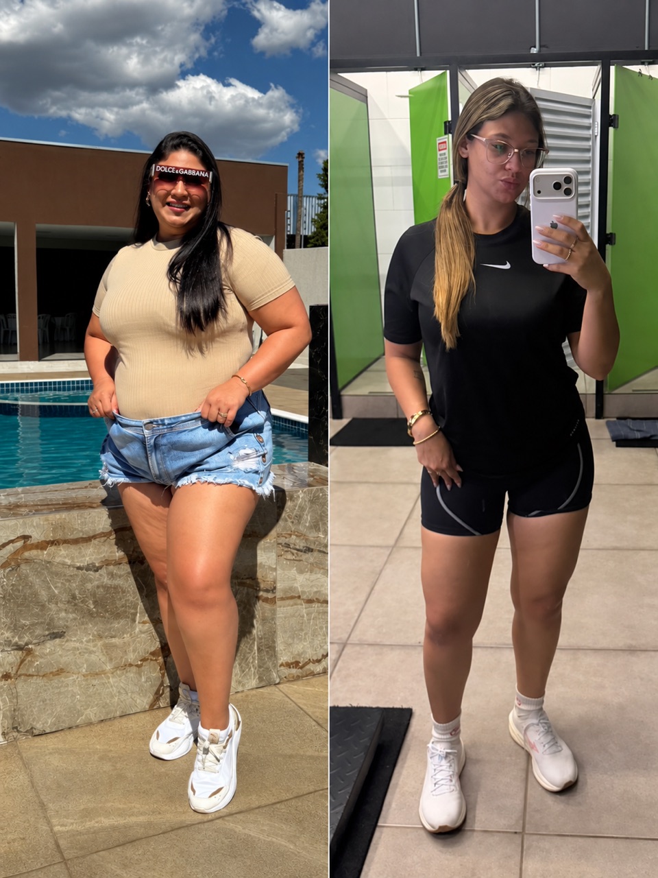 Antes e depois: paciente perdeu 40 kg