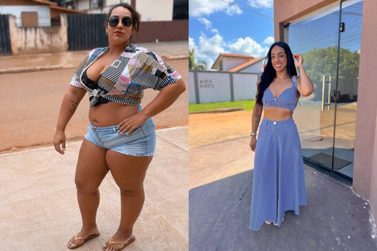 Antes e depois: paciente perdeu 55 kg